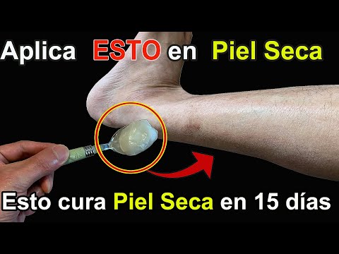Cura la Piel Seca (Xerosis) en solo 15 días con este Remedio Casero Genial