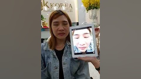 Ca Sửa Mí Hỏng Của Chị Khách Tại VTM JK Hàn Quốc