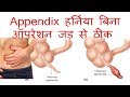 APPENDIX, हर्निया बिना ऑपरेशन जड़ से ठीक करने का देसी इलाज। APPENDIX, Harniya Without Surgery.