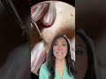 Double DPOW or cyst with two heads???