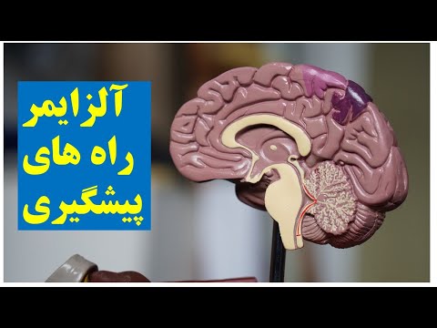 تصویری: زوال عقل یا آلزایمر کدام بدتر است؟