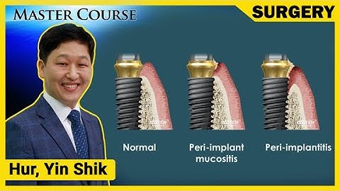 [Master Course Season2 - SURGERY] Peri implantitis