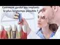 Contrôle et Entretien de l'implant dentaire - Comment garder ses implants le plus longtemps possible