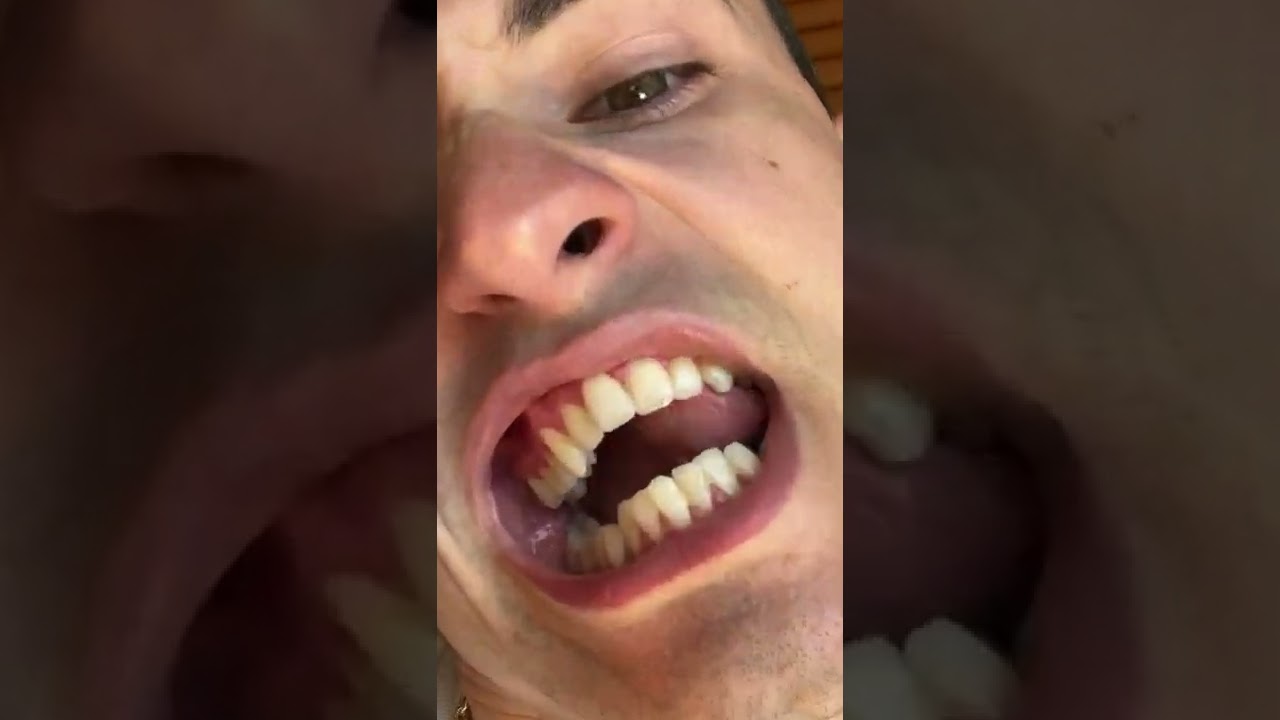 Cover INSANE 90° TONGUE ROLL 🔥