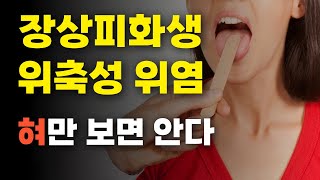 장상피화생 위축성 위염, 내시경 없이 혀만 봐도 내부 상태를 유추할 수 있습니다.