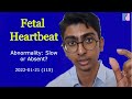 Fetal Heartbeat Abnormality: Possible Causes - Antai Hospitals