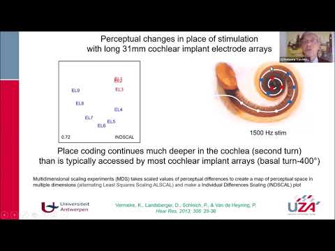 Stimulating the Second Turn of the Cochlea: Prof. Paul Van de Heyning | MED-EL ExpertsOnline #12