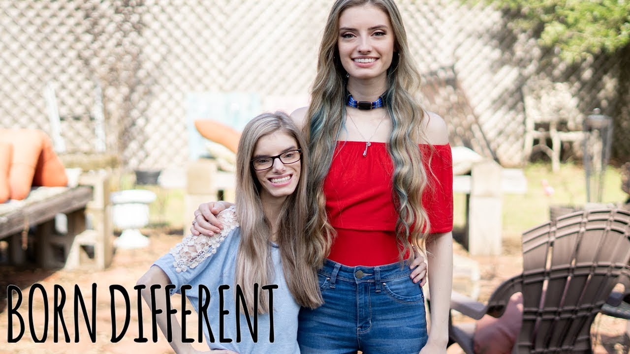 My Identical Twin With Dwarfism | BORN DIFFERENT