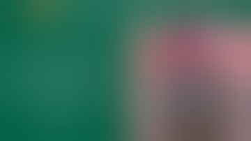 Repositioning a Dislocated IOL Using Hoffman Pockets