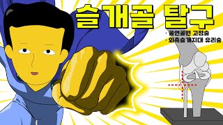슬개골 탈구11 -  골연골편 고정술, 외측슬개지대 유리술