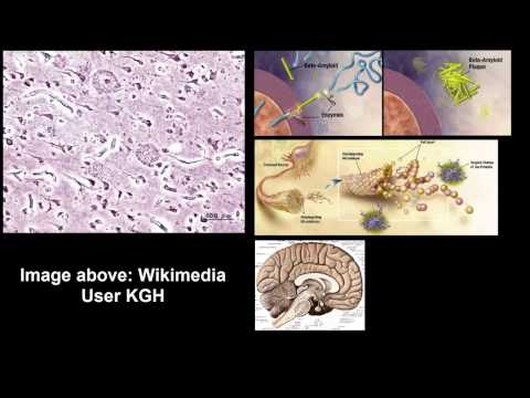 Biological basis of alzheimer&rsquo;s disease