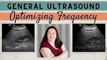 General Ultrasound | Frequency How-To Guide