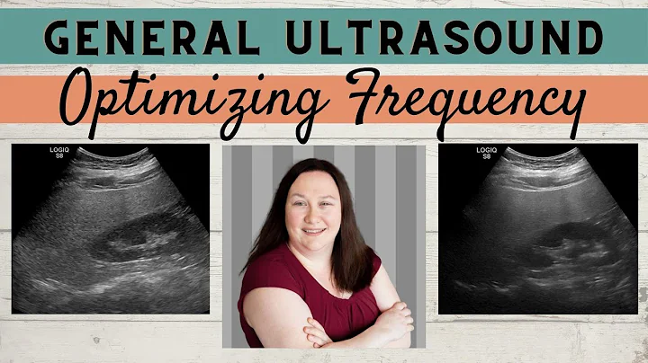 General Ultrasound | Frequency How-To Guide