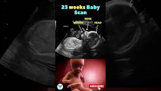 23 weeks baby scan during Pregnancy | Pregnancy scan #babyscan #pregnancy #shorts