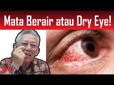 Video: Rawatan Rumah Untuk Mata Gatal: Rawatan Yang Benar-benar Berfungsi