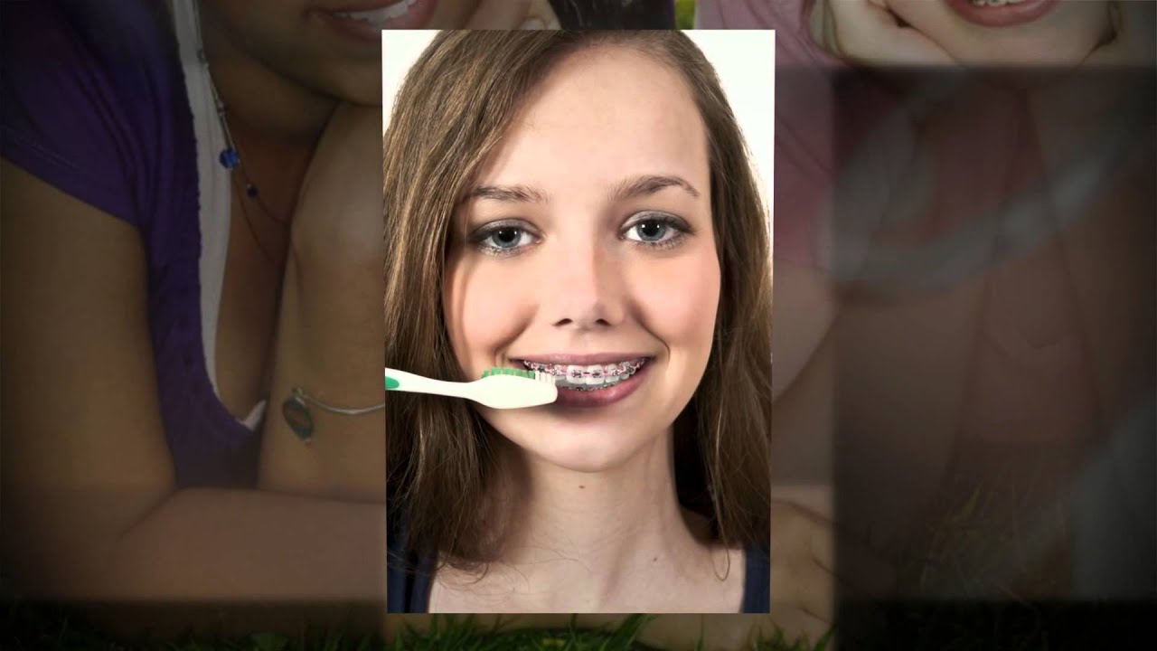 Orthodontist Office Dallas TX YouTube