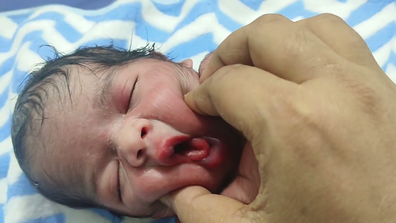 So cute boy 😍😍 naw Babu love 😘😘 my love Hospital 😍😍