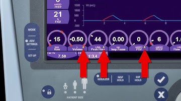 AVEA™ Ventilator: Controls