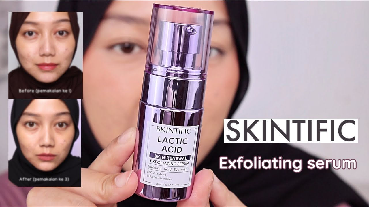 Review & Cara Pakai Exfoliating Serum SKINTIFIC Lactic Acid Skin