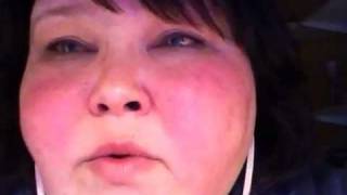 Lupus 1-21-11 a day in life with lupus vlog