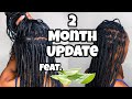 ALOE VERA + KNOTLESS BRAIDS REMOVAL | HAIR GROWTH | 2 MONTH UPDATE