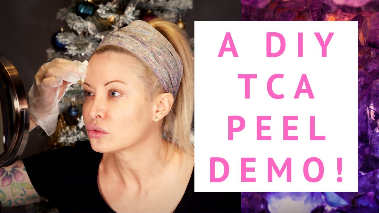DIY 25 TCA Peel How To Demo YouTube