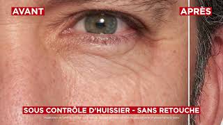 [NOUVEAU REVITALIFT LASER] Correcteur de poches instantané