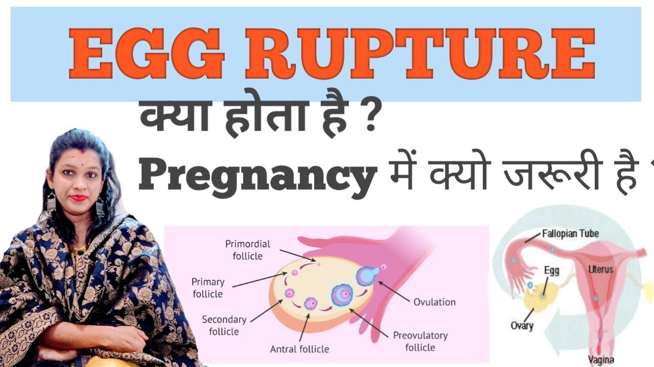 Egg Rupture क्या होता है और यह क्यों जरूरी है || #Follicle study में ...