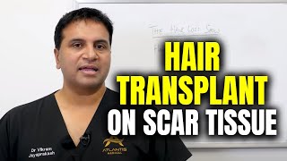 Hair Transplant Into Scars