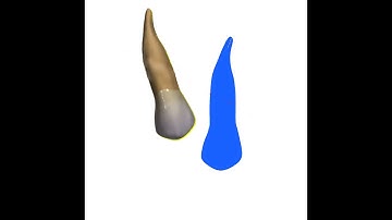 Root movement with orthodontic aligners