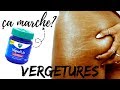 Vergetures la vrit sur le vicks vaporub