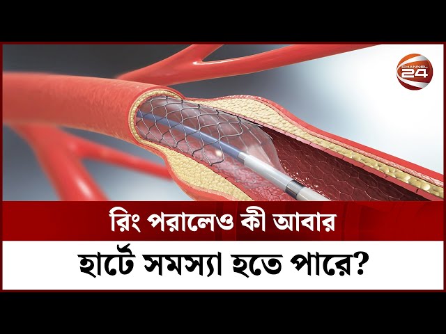 রিং পরালেও কী আবার হার্টে সমস্যা হতে পারে? | Heart Ring Surgery | Channel 24 class=