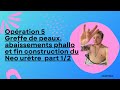 Opration 5 greffe de peaux abaissements phallo et fin construction neo urtre part 12  crazyden