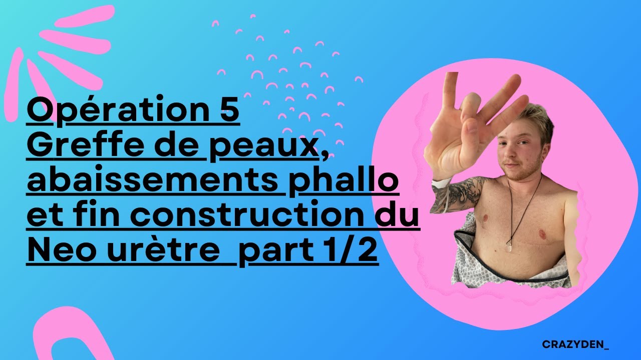 Opération 5 Greffe de peaux, abaissements phallo et fin construction neo urètre part 1/2 // CRAZYDEN