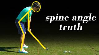 Spine angle isn't