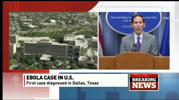 1st Ebola case diagnosed in U.S. confirmed by CDC