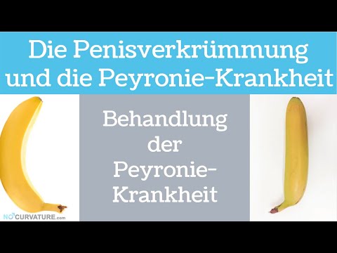 Penisverkrümmung: Behandlung der Peyronie-Krankheit