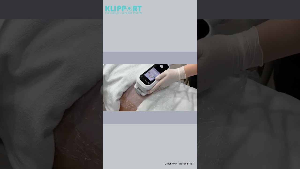Cryolipolysis Machine by Klipport | Easy Slimming & Fat Freezing Technology ❄️