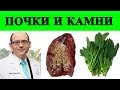 🔴 Камни в Почках и Шпинат, не ешьте слишком много! - доктор Майкл Грегер