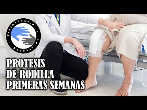 Vídeo: Después Del Reemplazo Total De Rodilla: Las Recomendaciones Que Debe Seguir