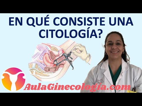 ¿EN QUÉ CONSISTE UNA CITOLOGÍA o PRUEBA DE PAPANICOLAU?   - Ginecología y Obstetricia -.