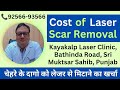 चेहरे पर दाग निकालने का खर्चा | Cost of Treatment of Face Scars, KAYAKALP LASER. 9256693566