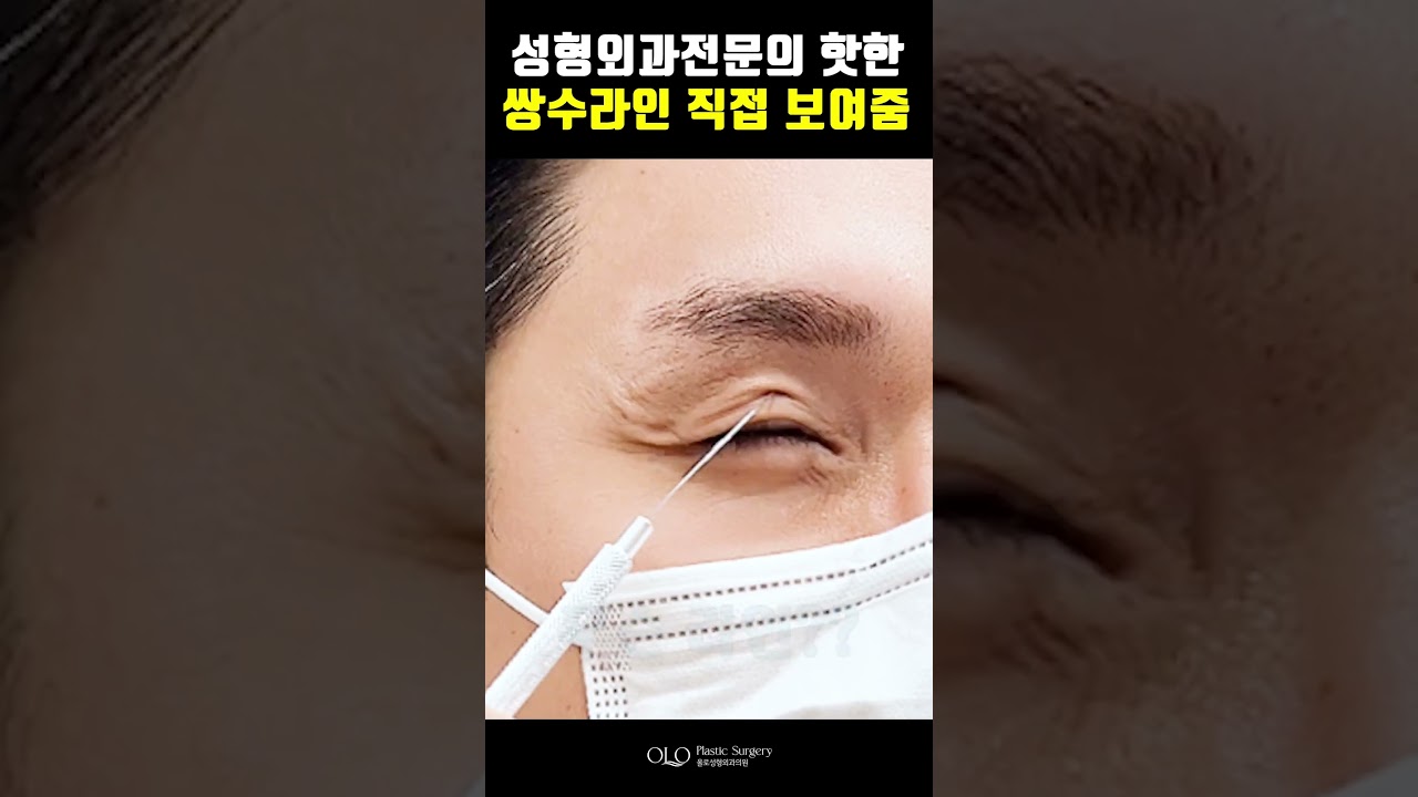 [Olo Plastic Surgery Clinic] #Chuyên_gia_phẫu_thuật_thẩm_mỹ hot #Đường_mí_đôi #Tự_mình_cho_xem! Bắt đầu thiết kế~! #shorts