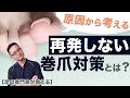 【足の専門家が教える】巻き爪を根本的に改善する、目からウロコの考え方とは