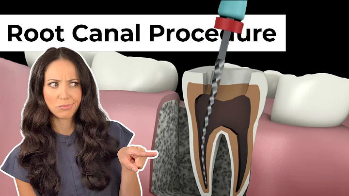 Root Canal Procedure Step by Step - DayDayNews