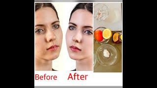 How to get whiten and soft skin - ماسک که پوست صورت تان را مثل  آینه  صاف میکند screenshot 2