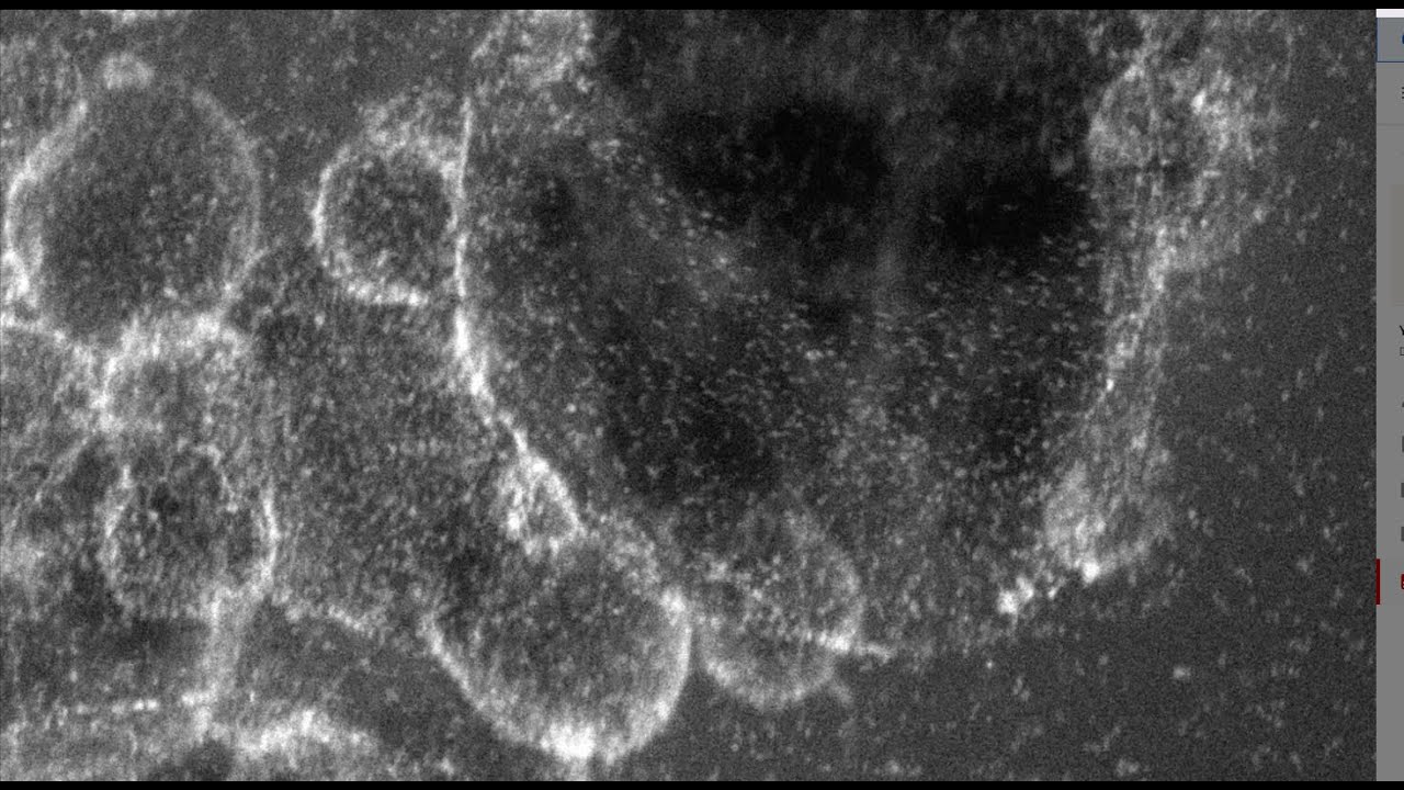 Projections and length scales in electron microscopy - YouTube