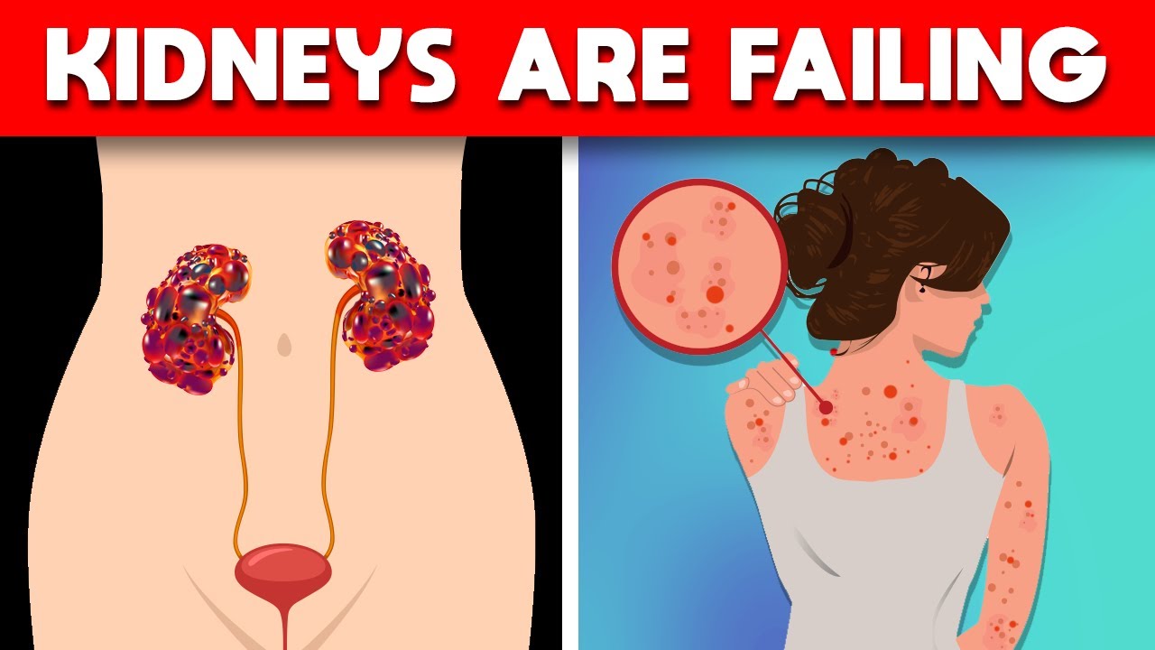 7 Signs Your Kidneys are Crying for Help | Healthonic Wellness