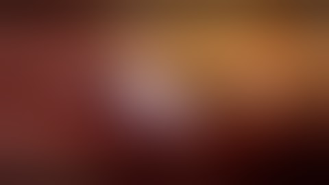 Endoscopic Anterior Component Separation with Laparoscopic  IPOM Plus