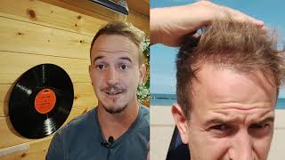 The Truth About Dr Cinik Clinic 1 Year Review After Hair Transplant Cheap Hair Transplant Turkey